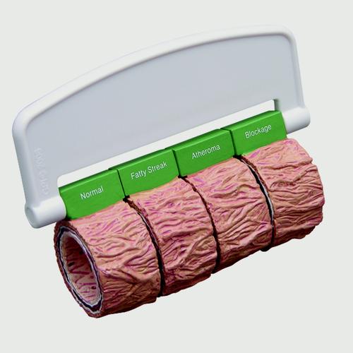 Artärsnitt (4) (stor) - med handtag
